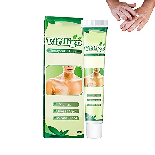 Crème hydratante à base de mélanine pigmentée, crème Vitiligo pour les taches blanches sur la peau, réduit les taches blanches sur la peau et améliore la pigmentation de la peau (1 pièce) Cover