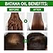 Marianp Batana Oil For Hair Growth - Raw 100% Pure Organic - Dr. Sebi Batana Oil From Honduras - For Stronger Thicker Longer Hair, Enhances Hair & Scalp Radiance, Repair Damaged Hair, Brown