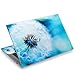 Laptop Skin Sticker Decal,12" 13" 13.3" 14" 15" 15.4" 15.6 inch Laptop Skin Sticker Cover Art Decal Protector Notebook PC (Dandelion)