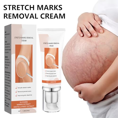 2Pcs Stretch Mark Cream 45g Eficaz Firmador Pele Hidratante Confiável Creme Remoção de Cicatrizes pa