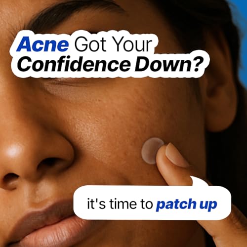 Image of Sotrue Acne Pimple Patches For Face | For Active Surface Acne | Hydrocolloid Waterproof Patches | Absorbs Pimple Overnight, Reduces Excess Oil | Suits All Skin Types (54 Patches)