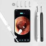 Ear Wax Removal,Ear Wax Removal kit,Ear Wax Removal Tool Camera,1080P Hd Endoscope, Wireless Ear Cleaner Tools with,6 Led Lights Waterproof Ear Scope Compatible with iPhone & Android Phones… (White)