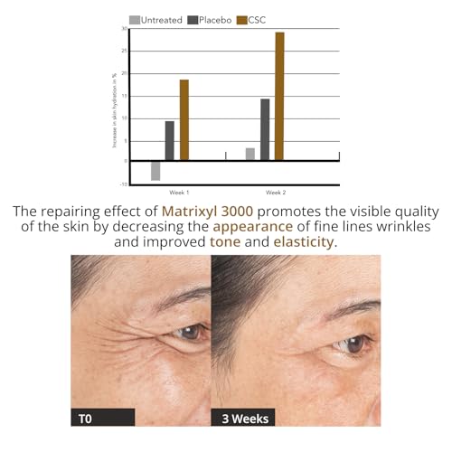Image of Nature's Kinn Face Serum Multi Peptide Serum 30ml, Matrixyl 3000, Hyaluronic Acid, Cactus Plant Stem Extract Provides Intense Hydration, Boost Collagen, Firm and Smooth Skin, Minimize Fine Lines and Wrinkles 30ml