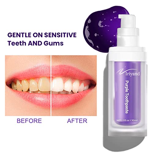 Purple Toothpaste For Teeth Whitening, Purple Toothpaste, Purple Teeth Whitening, Tooth Stain Removal, Teeth Whitening Booster, Teeth Whitener #TOP5