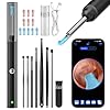 Ear Wax Removal, Ear Cleaner with 8 Pcs Ear Set, Ear Wax Removal Kit, 1296P HD Endoscope with 6 LED Lights, Kids Adults Ear Cleaning Gift, Compatible with iPhone & Android Smart Phones