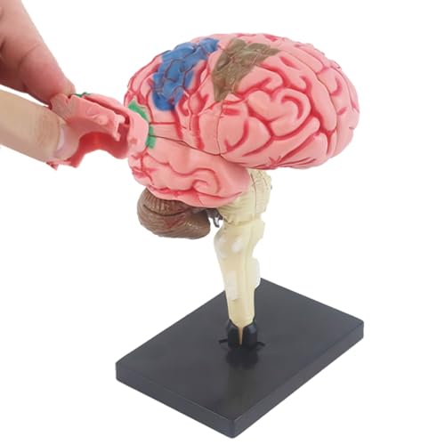 Realistico e dettagliato: illumina i segreti del cervello con il nostro modello di cervello umano estremamente dettagliato e splendidamente dipinto molto simile al vero affare. Ottieni una migliore comprensione della struttura e della funzione del cervello con il nostro modello in miniatura ad alta precisione.