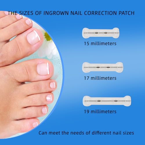 Titanium Alloy Silicone Ingrown Toenail Treatment, Designed for Curved Nail Repair, Ingrown Toenail Corrector, Nail correction tool, Ingrown Toenail Removal Kit,Suitable for Any Toenail Size men woman