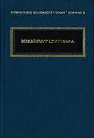 Malignant Lymphoma (Monographs in Pathology) 0683006010 Book Cover