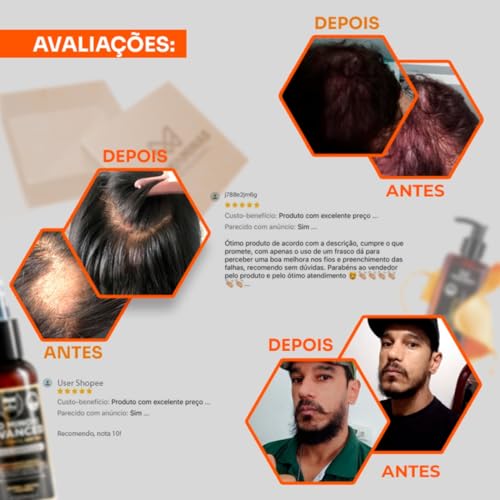 Tônico Pro Minoxi Advanced 120ml Gran Cosmética Produto Crescimento e Antiqueda Capilar Nasce Barba