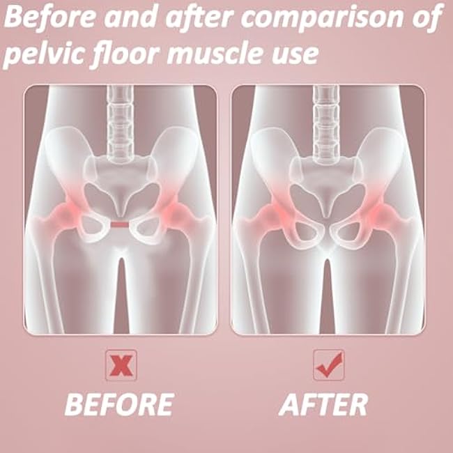 Pelvic and Thigh Master | Women's Pelvic Floor Exercise Devices Trainer | Kegel Exerciser, Thigh Muscle Exercise Devices with Display Counter