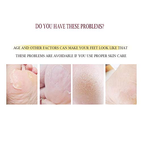 The 29 Best Foot & Hand Care Scrubs of 2024 [Verified] Cherry Picks