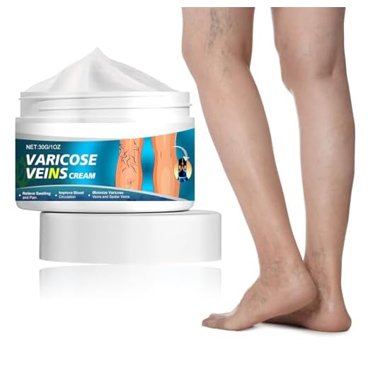 Crema Eliminación de Venas Varicosas,Crema Reparadora de Venas,Eliminación Arañas Vasculares,para Eliminar Varices para Piernas Mejorar la Circulación Sanguínea,30G