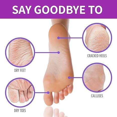 ERITIN Foot Peel Mask for Women & Men | Peeling & Exfoliating Foot Mask for Dry Cracked Feet, Removes Dead Skin & Calluses, Hydrates & Smooths Cracked Heels (Pack of 1) (LAVENDER) 2