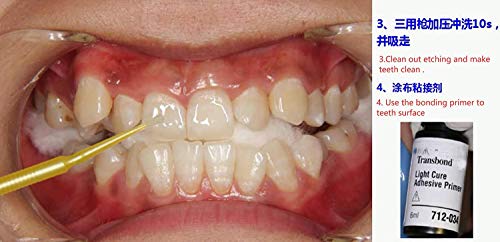 Adhesivo ortodoncia OrthoForce kit de cemento dental para brackets de metal 4