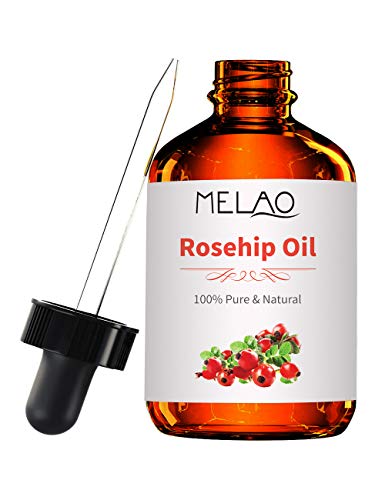 Organic Rosehip Oil, Moisturizer for Face, Nails, Hair and Skin， 100% Pure & Natural, Cold Pressed by SAISZE - 4 oz