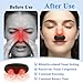 Qubrzo Red Light Nose Care Device, LED Nose Wellness Tool for Daily Nasal Comfort, USB Rechargeable Portable Design with 3 Light Modes & Auto Shut-Off, Black