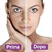 Imagen de Dermaroller Titanio Kit Derma Roller 6 en 1 Microneedle Roller Dermaroller Facial para Brillos Cara Ojos Cuerpo y Cabello Rodillo de Microagujas de Piel Anti-Manchas Arrugas Cicatrices Celulitis etc