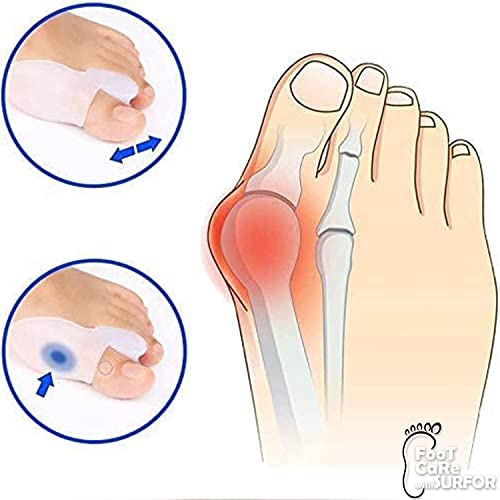 Image of Toe Separator for Feet Toe Spacers Correct Toes Yoga Silicone Hammer Toe Corrector for Women & Men Correct Toe Straighteners for Overlapping Toes (Toe separator)