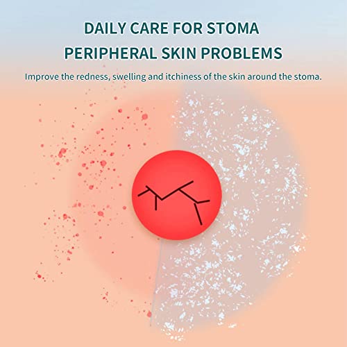 stoma powderskin barrier protection ostomy powder supplies - stoma adhesive powder1 oz 2 bottles