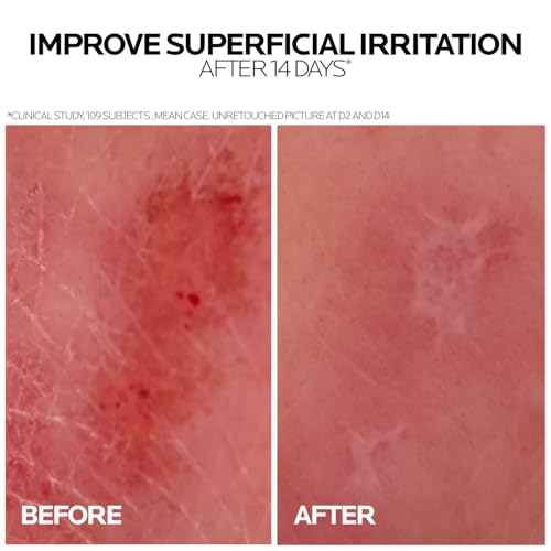 Image of La Roche-Posay Cicaplast Baume B5+ Repair Moisturiser Balm, 40ml | ACCELERATES REPAIR FROM 1 USE, DERM-RECOMMENDED, ADVANCED REPAIR FORMULA, Effective against 15+ indications