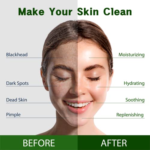 Purederm Vegan Aloe Sheet Masks (12 Packs) – Facial Sheet Mask For Soothing & Hydrating Treatment thumb #2