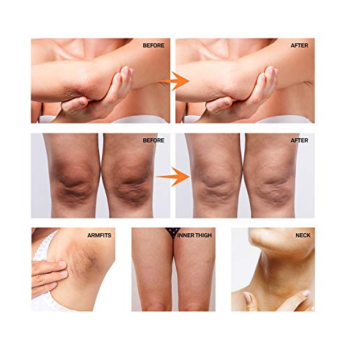 AsaVea Dark Spot Cream Natural Underarm Cream, Instant Result, Crotch & Nipple Dark Spot Corrector