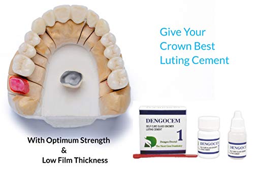 Dengen Dental Glass Ionomer Luting Cement Powder-15g, Liquid- 10ml