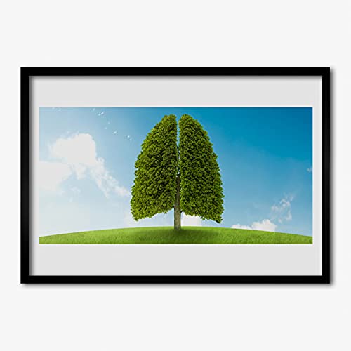 Affiche encadrée 70x50 cm Tulup cadre MDF décoration murale salon cuisine faune pulmonaire d'herbe
