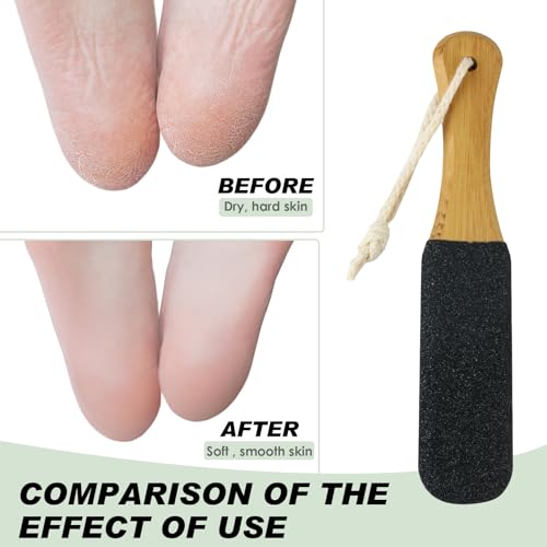 Foot File Pumice Stone Natural Pumice Stones for Feet, Premium Exfoliator & Foot File, Foot File Callus Remover Foot Cracked Heels, Dead Skin & Callus Remover for Soft and Delicate Feet, Black - Image 6