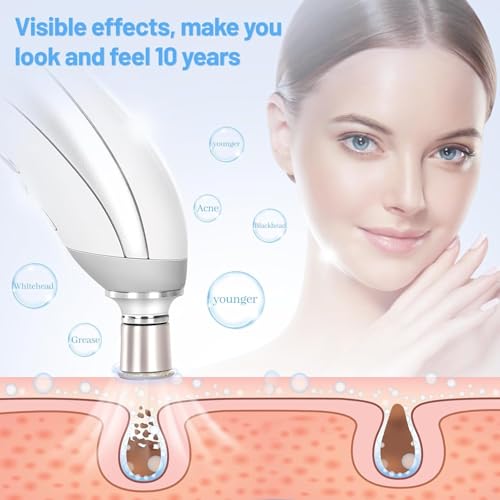 Appareil de microdermabrasion diamant visage et kit points noirs efficace - 2