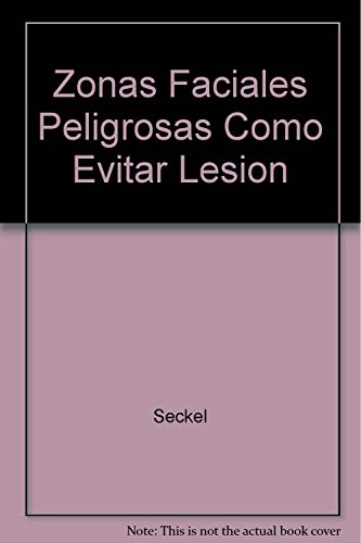Zonas Faciales Peligrosas Como Evitar Lesion (Spanish Edition)