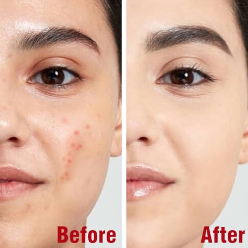 FATAZEN Turmeric Face Oil | Natural Glow Turmeric Facial Oil for Anti-Aging & Antioxidant, Tea Tree Oil with Aloe Vera + Witch Hazel + Jojoba, Lightweight Serum for Sensitive Skin & All Skin