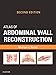 Atlas of Abdominal Wall Reconstruction E-Book