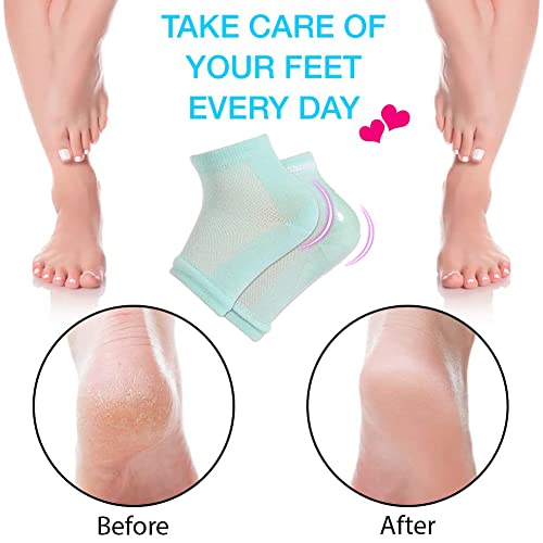 Toulifly Calzini in Gel per Talloni, Calzini