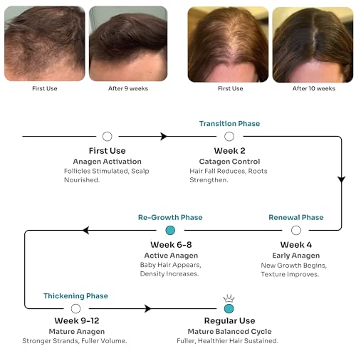 Image of Kitcoz Hair Growth Serum, 21% Actives, Redensyl, Procapil & Anagain, 30ml | Clinically backed ingredients that reduces hair fall and support stronger, thicker, fuller-looking hair