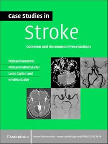 Case Studies in Stroke: Common and Uncommon Presentations (Case Studies in Neurology)