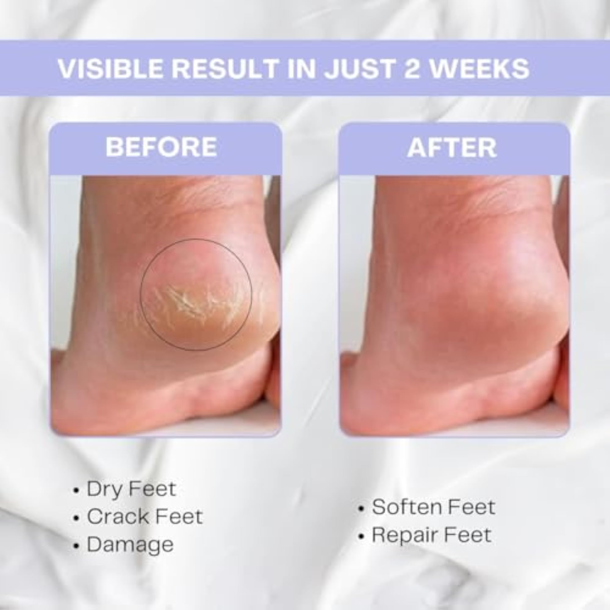 Double Defence Foot Repair Cream with Papaya & Aloe Vera