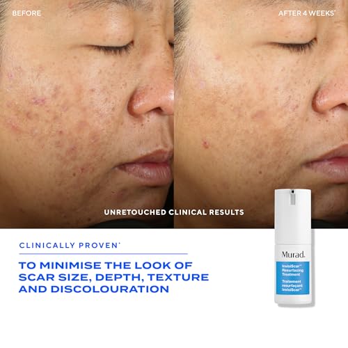 Murad InvisiScar Resurfacing Treatment – Acne Scar Solution with Vitamin C, Salicylic Acid & Centella Asiatica for Smoother Texture, Reduced Discoloration & Effectively Blurs Imperfections - 0.5 Fl Oz - Image 2