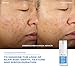 Murad InvisiScar Resurfacing Treatment – Acne Scar Solution with Vitamin C, Salicylic Acid & Centella Asiatica for Smoother Texture, Reduced Discoloration & Effectively Blurs Imperfections - 0.5 Fl Oz