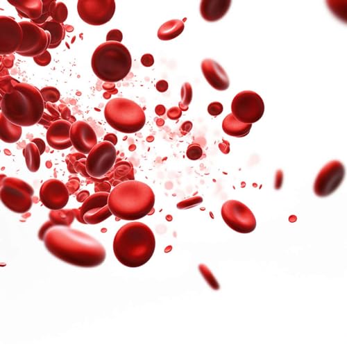 #39: Iron Deficiency Anaemia Podcast Por  arte de portada