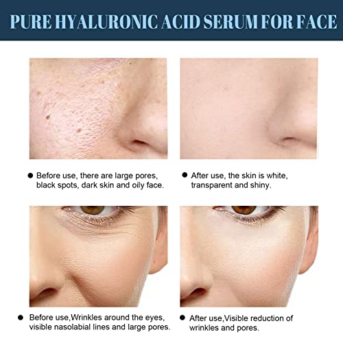 image for Protein Thread Lifting Kit - Protein Peptide - Collagen Skin Desalinat