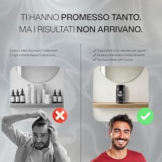 FOLT - Integratori per Capelli Uomo Alto Dosaggio - Biotina Cheratina e Zinco per Alopecia Androgenetica - Integratori Capelli con Vitamine per Capelli - Anticaduta Capelli Uomo - 30 Capsule