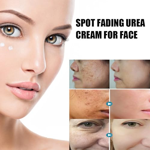 Spot Fading Urea Cream, Spot Fading cream,Urea Face Cream,Vtamin E Urea Cream,Reduce Dark Spots (3)