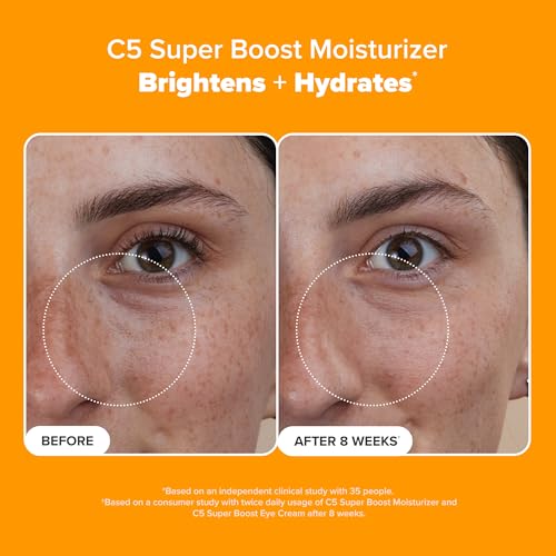 Paula's Choice C5 Super Boost Face Moisturizer with 5% Vitamin C & Squalane, Daily Face Lotion for Discoloration, Uneven Tone, Fine Lines & Breakout-Prone Skin, Fragrance-Free