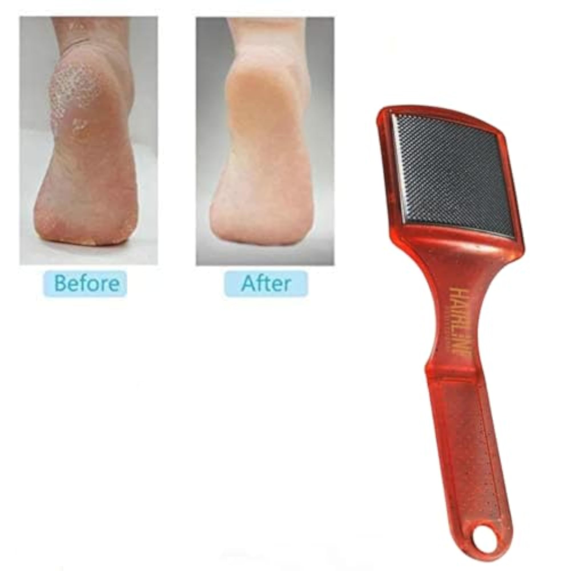 Professional Stainless Steel Foot Scraper Exfoliator for Callus Removal