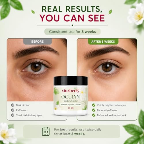 Image of VINZBERRY Oculyn Under Eye Gel, Reduces Dark Circles & Puffiness, with Niacinamide, Hyaluronic Acid, Aloe Vera & Green Tea, 20g