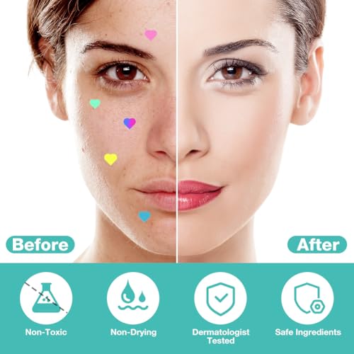 BUTBU 400 Stücks Herz Pimple Patch, Hydrokolloid Pickel-Patch Unsichtbare, Tag & Nacht 2-in-1 Akne Pflaster, mit Salicylsäure & Teebaumöl & Centella Asiatica, Wasserdicht Atmungsaktiv Acne Patches