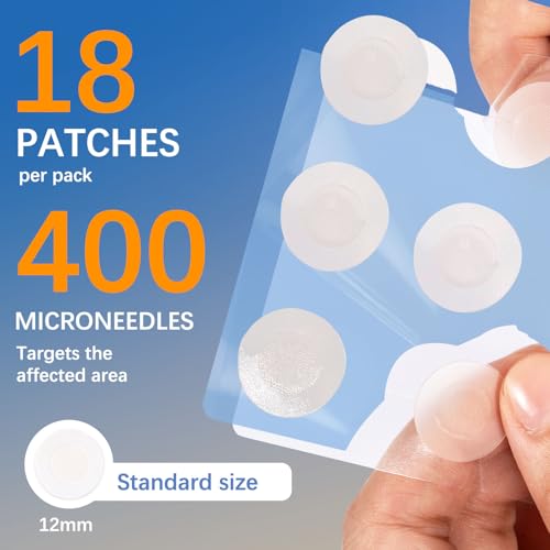 ACOTYE Microdart Anti Pickel Patch – Microneedle Akne Patches mit Salicylsäure & Teebaumöl, Hydrocolloid Patches gegen große Pickel im Gesicht, Kinn oder Rücken (18 Stück) (L, stück, 18)