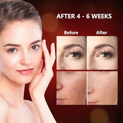 Image of 660nm & 850nm Red Light for Face, Soft LED Red Light Mask Face for Home Use