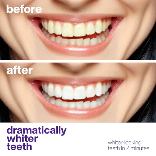 Image of AquaSonic Perfect Purple | Teeth Whitening, Color-Correcting Serum | Neutralize Yellow Stains | Mint Flavor